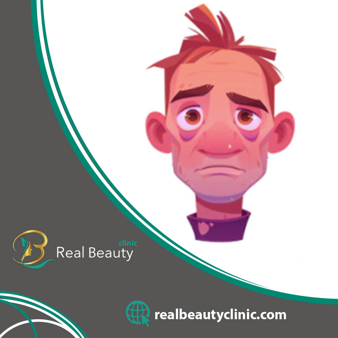 تجميل الانف في تركيا