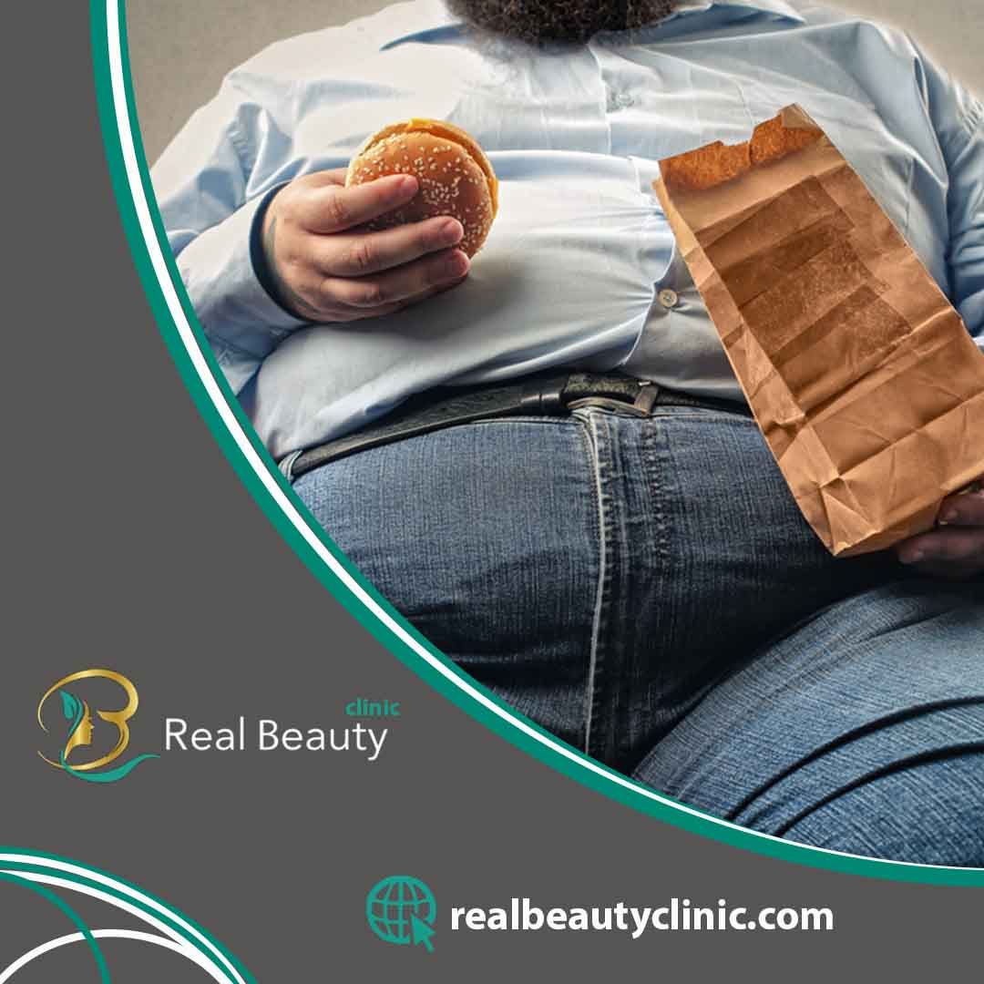 عملية تكميم المعدة