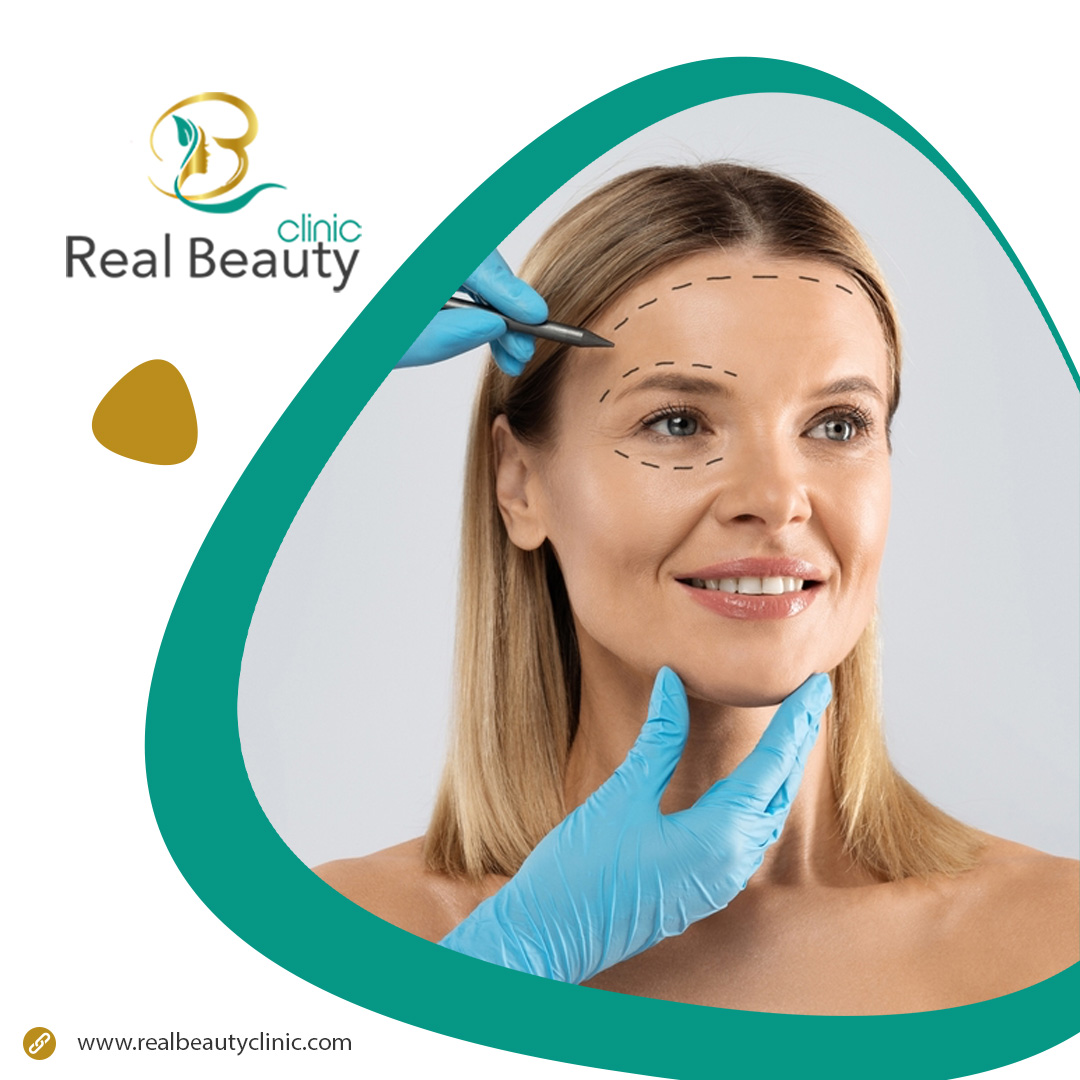 Redesign Your Reflection: Forehead Reduction Surgery in Turkey at ...